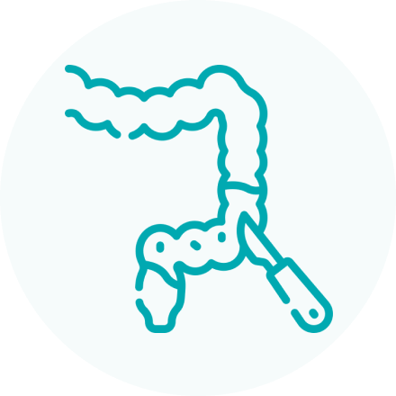 Colorectal_surgery.png